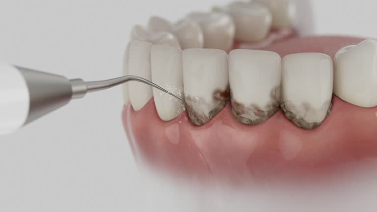Reliable Dental Implants contractor in Austin, IN by Smile Center Dentistry